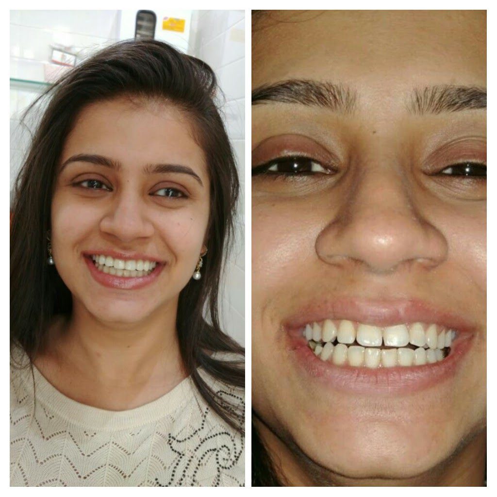 20180129_013656-COLLAGE